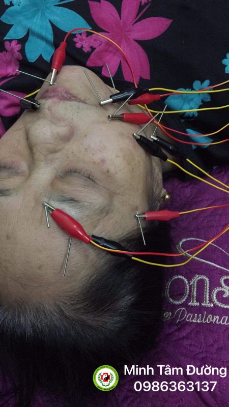 cham-cuu-tai-nha-tai-nghia-tan-cau-giay