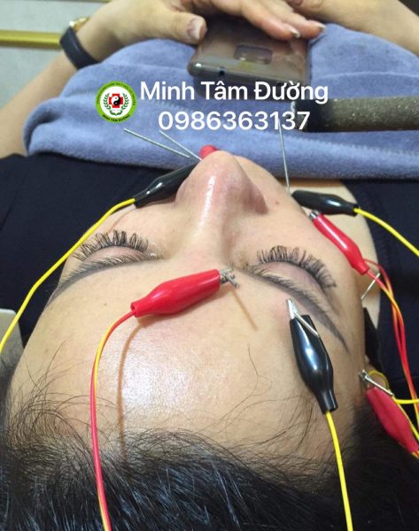 cham-cuu-tai-nha-tai-nghia-tan-cau-giay