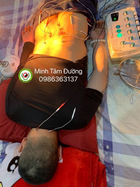 cham-cuu-tai-nha-tai-nghia-tan-cau-giay