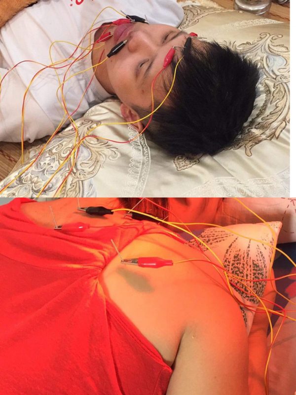 cham-cuu-tai-nha-tai-trung-van