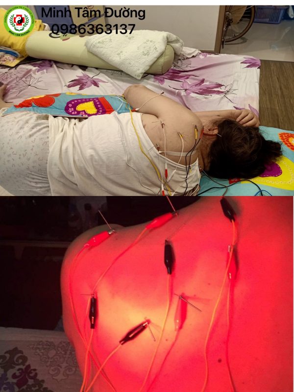 cham-cuu-tai-nha-tai-trung-van