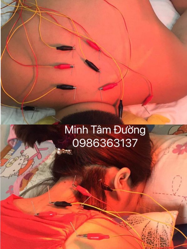 cham-cuu-tai-nha-tai-trung-van