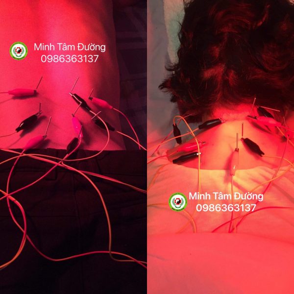 cham-cuu-tai-nha-tai-trung-van