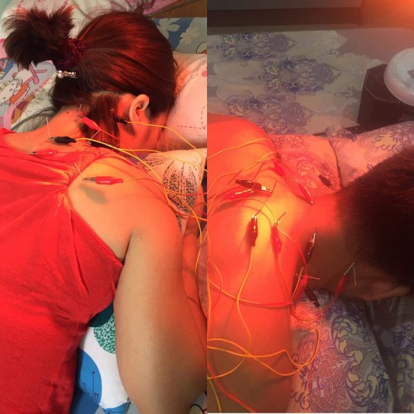 cham-cuu-tai-nha-tai-yen-hoa-cau-giay 