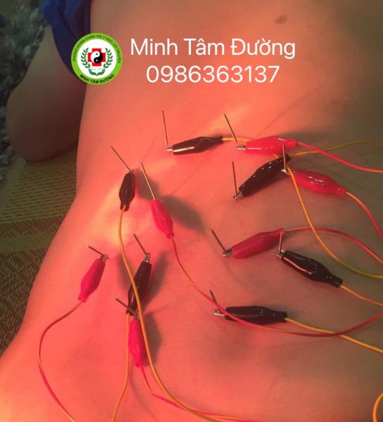 cham-cuu-tai-nha-xuan-dinh 