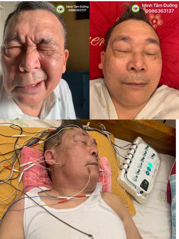 cham-cuu-tai-nha-xuan-dinh