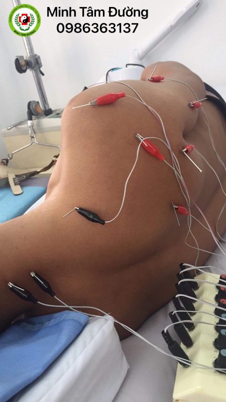 cham-cuu-tai-nha-xuan-dinh 