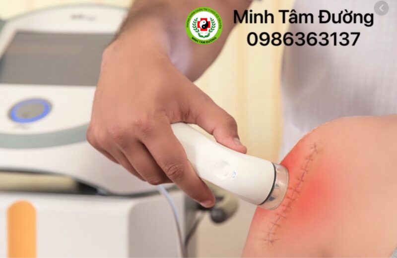 vat-ly-tri-lieu-tai-nha-tai-ha-cau 