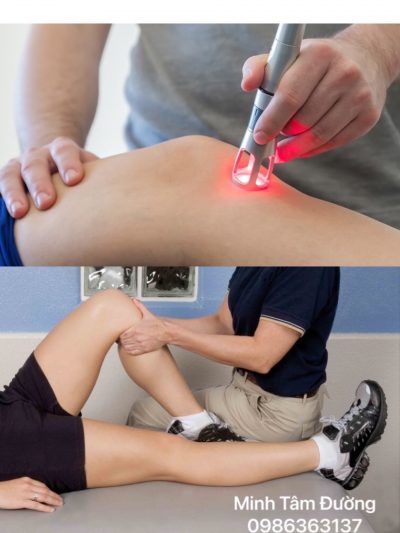 vat-ly-tri-lieu-tai-nha-ttai-tay-son-dng-da