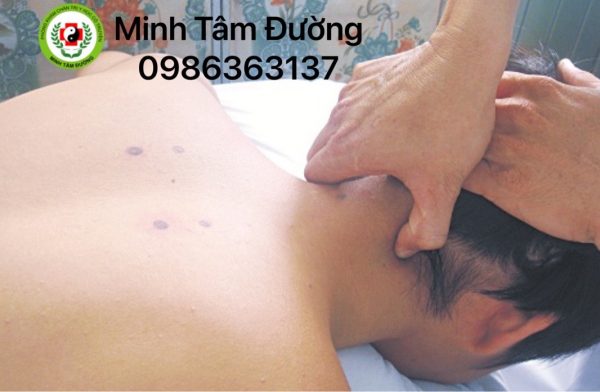 bam-huyet-tai-nha-tai-lac-long-quan-tay-ho bam-huyet-tai-nha-tai-lac-long-quan-tay-ho