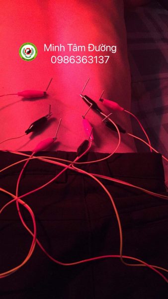 cham-cuu-tai-nha-tai-nguyen-luong-bang-dong-da