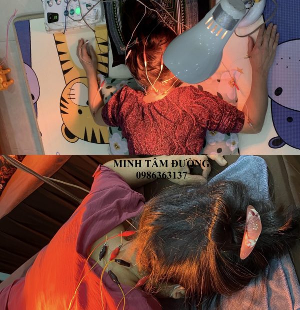 cham-cuu-tai-nha-tai-pham-ngoc-thach-dong-da  cham-cuu-tai-nha-tai-pham-ngoc-thach-dong-da